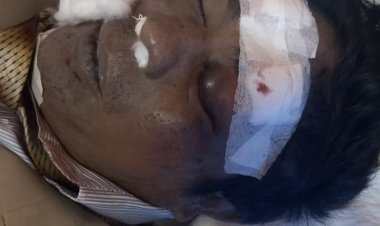 Mantan Tentara Tewas Dengan Banyak Luka, Saat Dijemput Polisi, Kapolres Sibolga " Karena Lari dan Terjatuh"